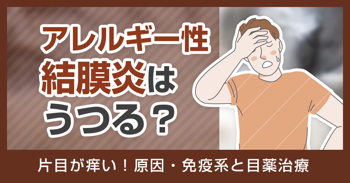 アレルギー性結膜炎はうつる？片目が痒い！原因・免疫系と目薬治療