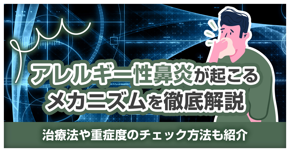 アレルギー性鼻炎が起こるメカニズムを徹底解説｜治療法や重症度のチェック方法も紹介
