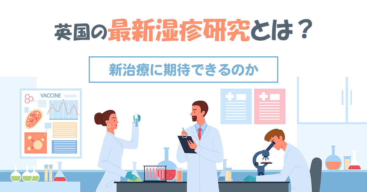 英国の最新湿疹研究とは？新治療に期待できるのか
