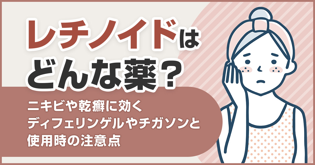 レチノイドはどんな薬？ニキビや乾癬に効くディフェリンゲルやチガソンと使用時の注意点
