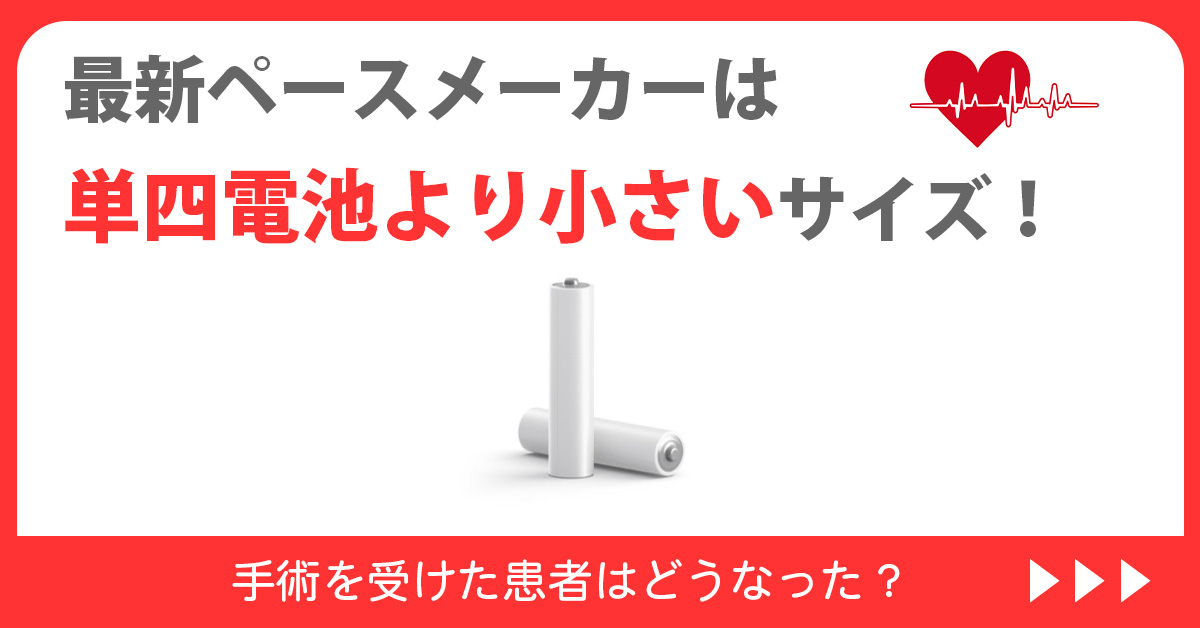 最新ペースメーカーは単四電池より小さいサイズ！手術を受けた患者はどうなった？