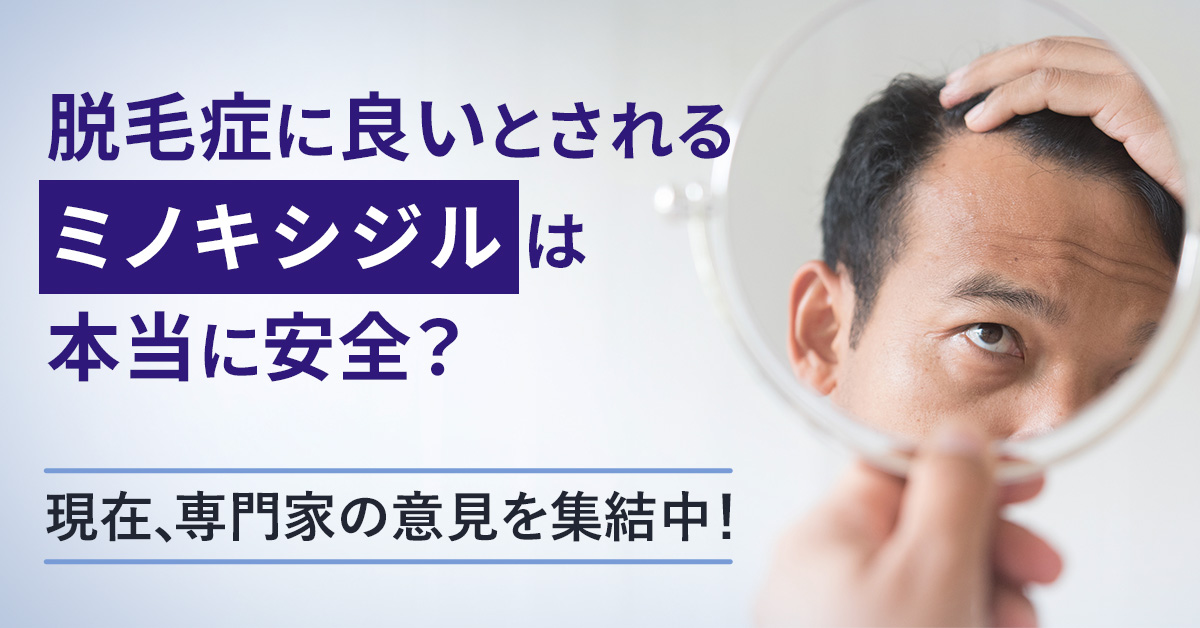 脱毛症に良いとされるミノキシジルは本当に安全？現在、専門家の意見を集結中！