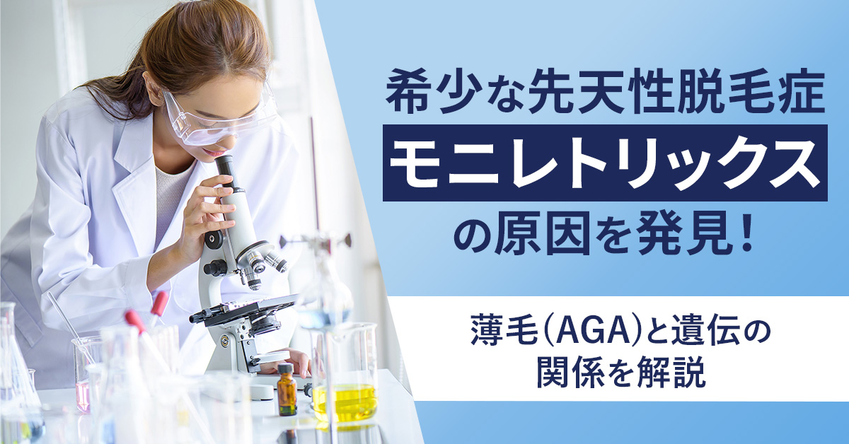 希少な先天性脱毛症「モニレトリックス」の原因を発見！薄毛(AGA)と遺伝の関係を解説