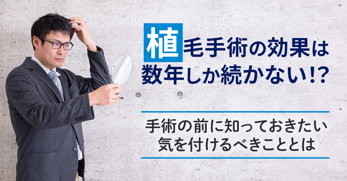 植毛手術の効果は数年しか続かない！？手術の前に知っておきたい気を付けるべきこととは