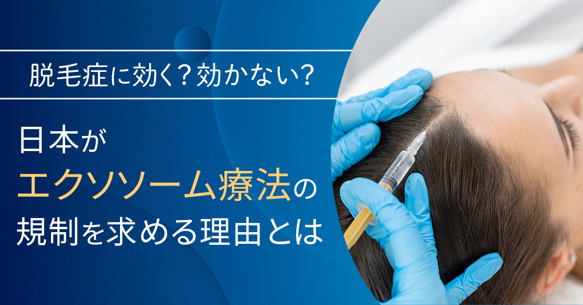 脱毛症に効く？効かない？日本が「エクソソーム療法」の規制を求める理由とは