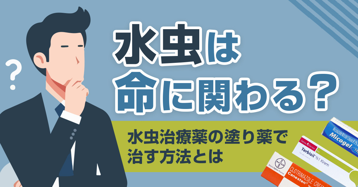 水虫は命に関わる？水虫治療薬の塗り薬で治す方法とは