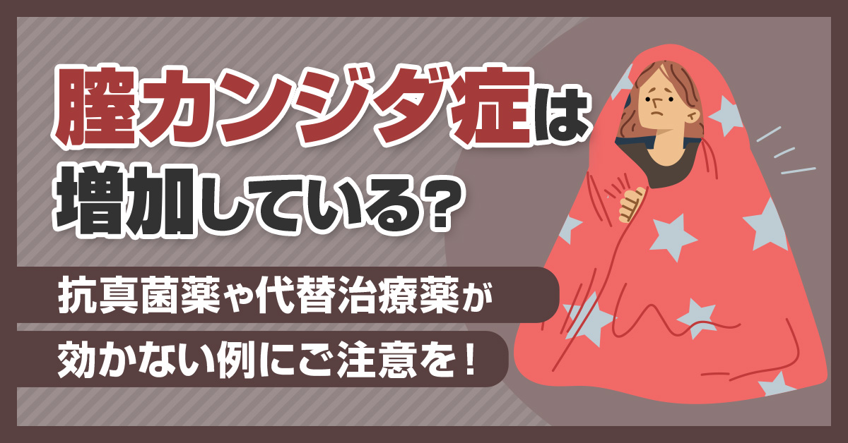 膣カンジダ症は増加している？抗真菌薬や代替治療薬が効かない例にご注意を！
