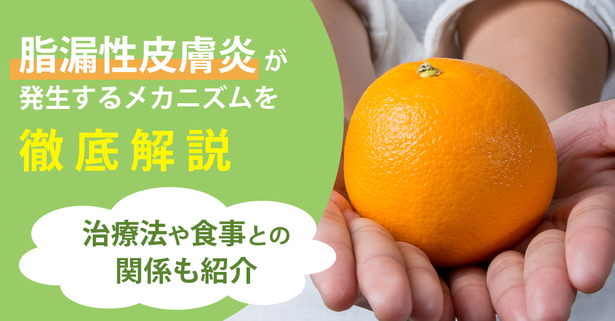 脂漏性皮膚炎が発生するメカニズムを徹底解説｜治療法や食事との関係も紹介