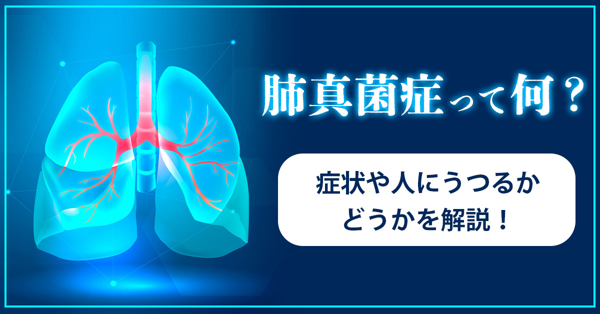 肺真菌症って何？症状や人にうつるかどうかを解説！